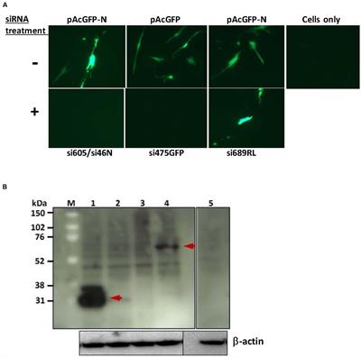 Short Interfering RNA Inhibits Rift Valley Fever Virus Replication and Degradation of Protein Kinase R in Human Cells